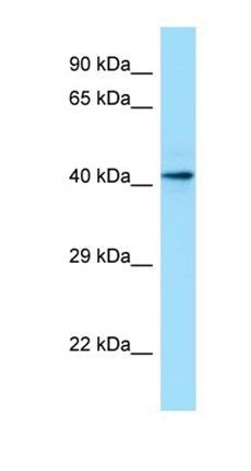 CASQ1 antibody