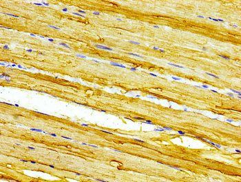 CASQ2 antibody