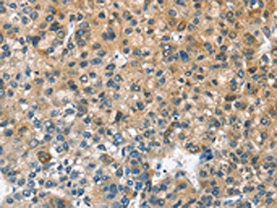 CASQ2 Antibody