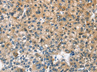 CASQ2 antibody