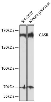 CASR antibody