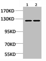 CASR antibody