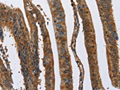 CAST Antibody