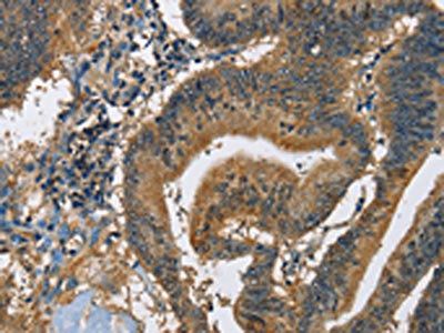 CAST Antibody