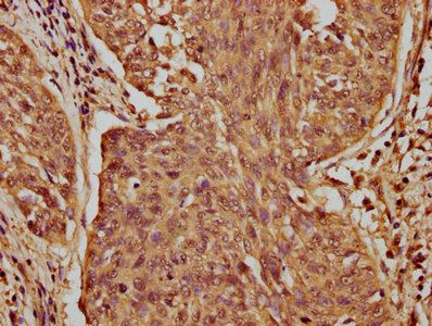 CASZ1 Antibody