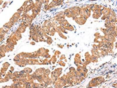 CASZ1 Antibody