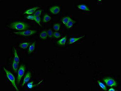 Catechol O-methyltransferase antibody