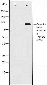 Catenin-beta (Phospho-Thr41/Ser45) antibody