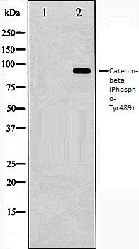 Catenin-beta (Phospho-Tyr489) antibody