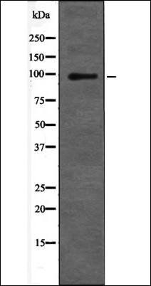 Catenin- beta (Phospho-Ser675) antibody
