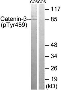 Catenin-beta (phospho-Tyr489) antibody