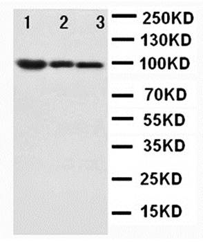 Anti-beta Catenin/CTNNB1 Antibody