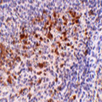 Cathelicidin Antibody