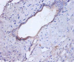 Cathepsin B antibody