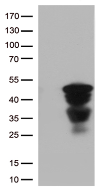 Cathepsin L Antibody