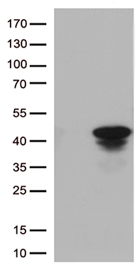 Cathepsin L (CTSL) antibody