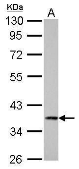 Cathepsin S Rabbit Polyclonal Antibody