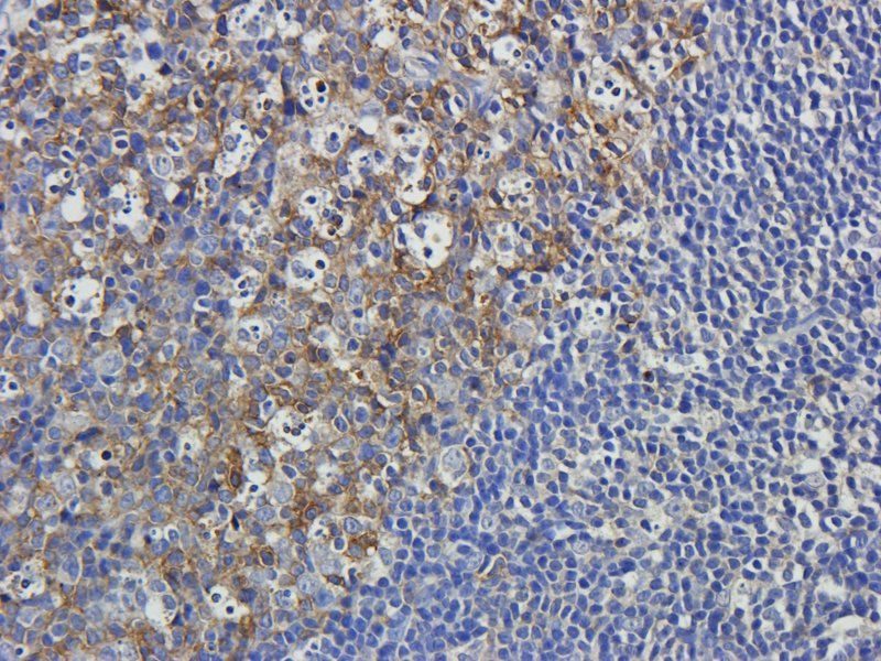 Cathepsin G Rabbit Polyclonal Antibody