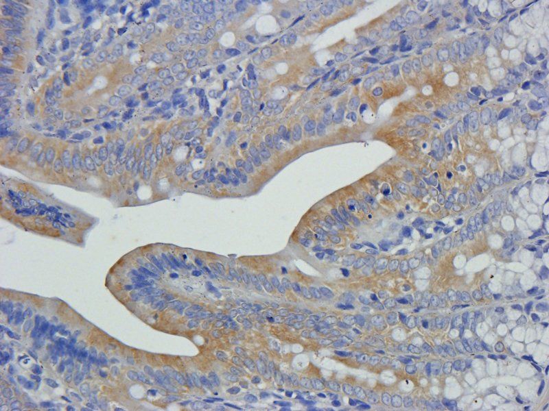 Cathepsin G Rabbit Polyclonal Antibody