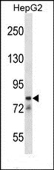 CATSPER1 antibody