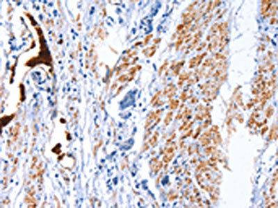 CATSPER1 antibody