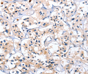 CATSPER1 Antibody