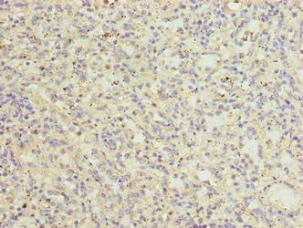 CATSPER2 Antibody