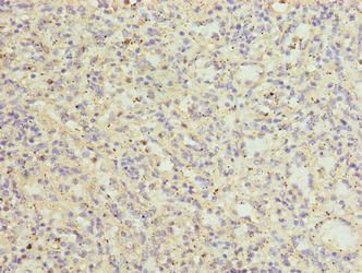 CATSPER2 antibody