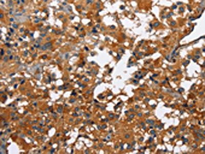 CATSPER3 Antibody