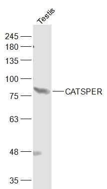 CATSPER antibody