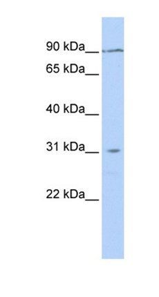 CATSPERD antibody