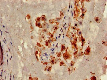 CAV2 Antibody