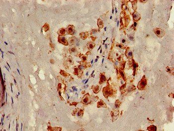 CAV2 antibody