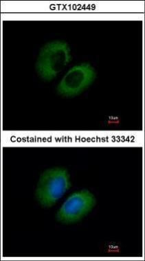 Cav2.2 Rabbit Polyclonal Antibody