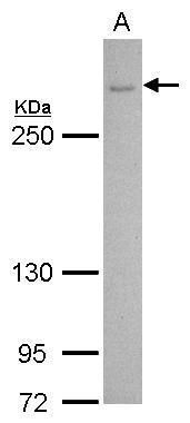 Cav2.2 Rabbit Polyclonal Antibody
