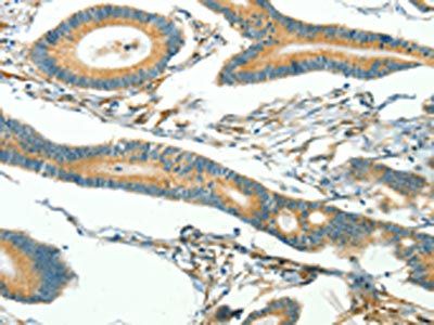CAV3 Antibody