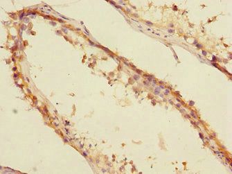 CBFA2T2 Antibody