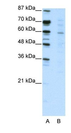 CBFA2T3 antibody