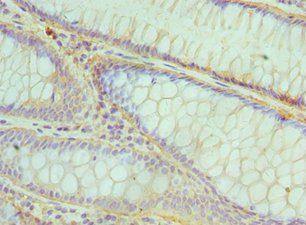 CBFB Antibody