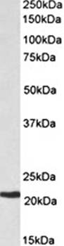 Goat anti-CBFB Antibody