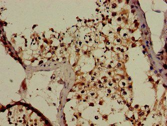 CBL Antibody