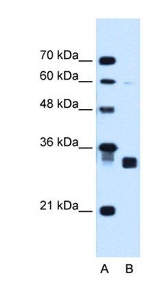 CBR1 antibody