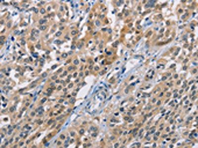 CBR1 Antibody