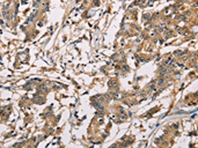 CBR1 antibody