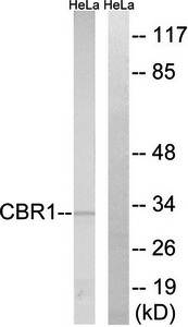 CBR1 Antibody