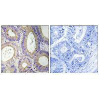 CBR3 Antibody