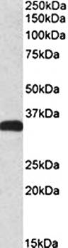 Goat anti-CBR3 Antibody