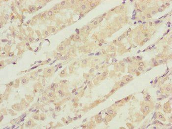 CBR4 antibody