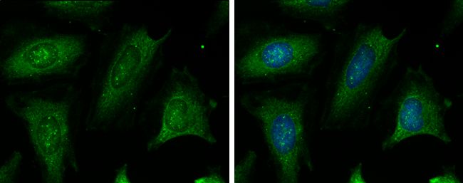 cystathionine-beta-synthase Antibody