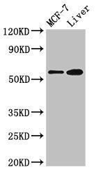 CBS antibody